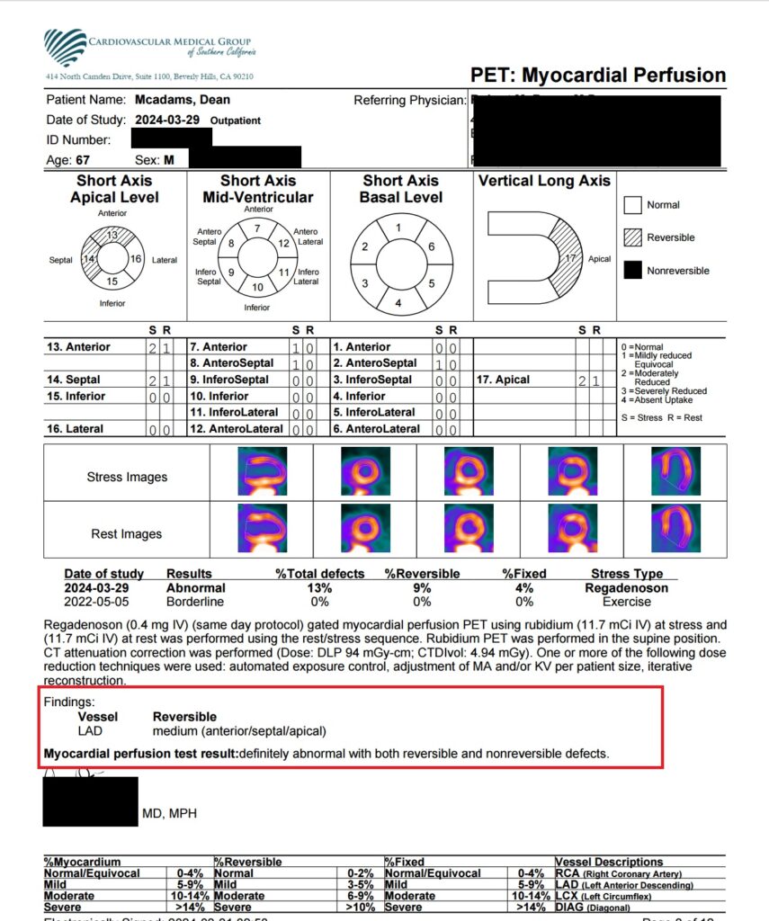 abnormal pet scan  test results