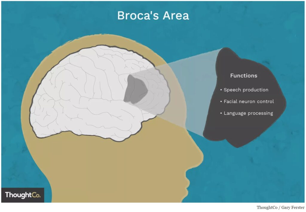 trauma damages left brain speech